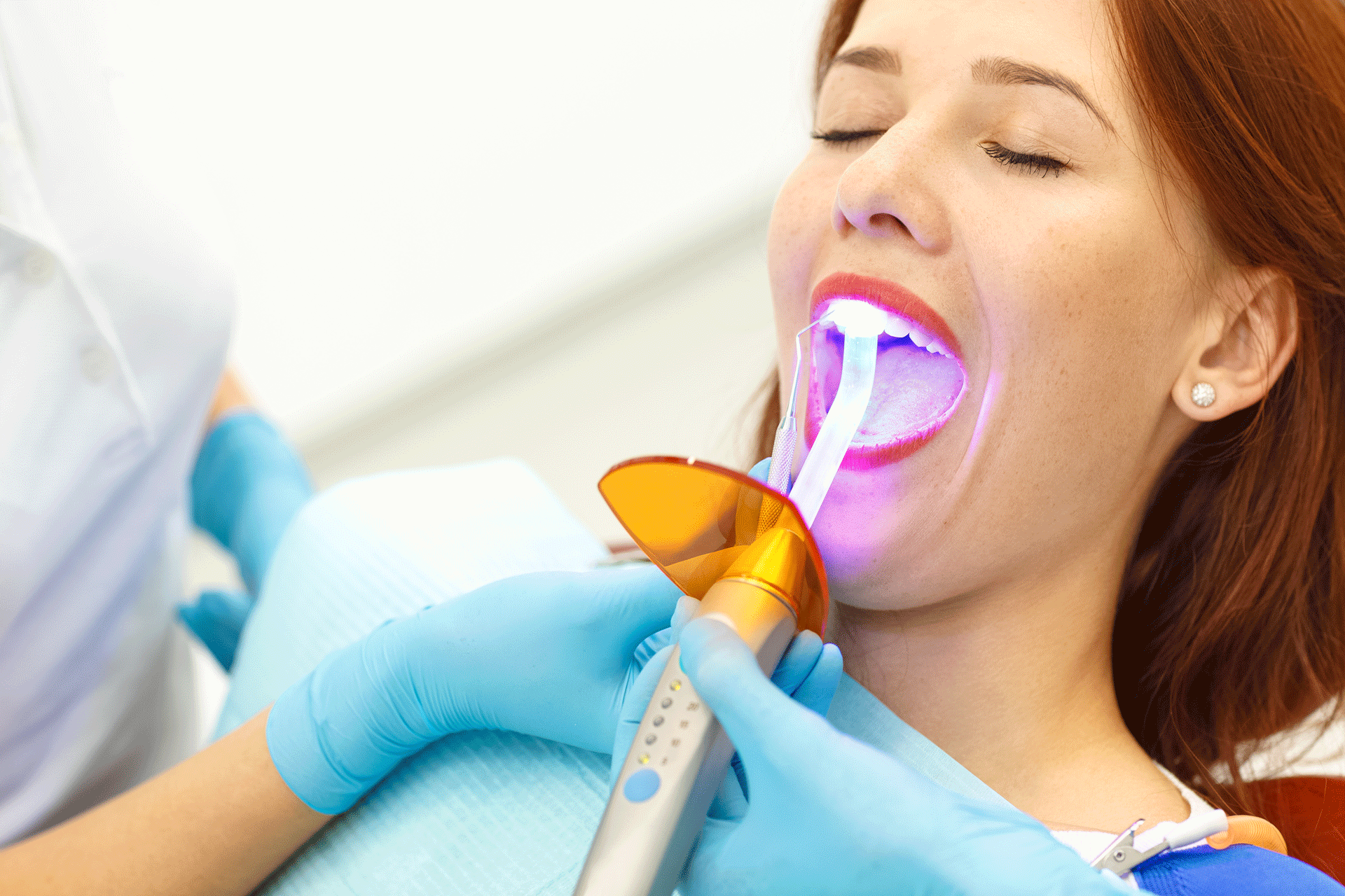 dental bonding cosmetic dentistry services phoeix glendale dentist